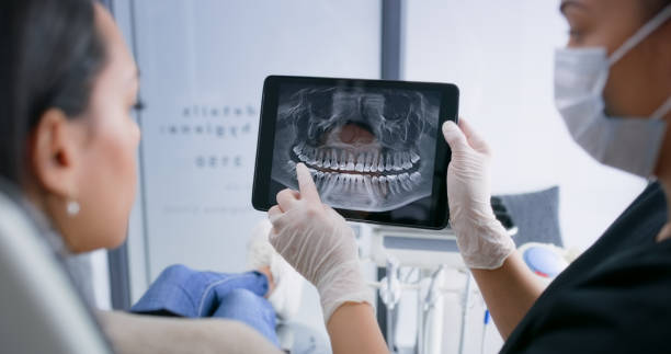 Licensed Tooth Extraction service in Burlington, CO - Smile Center Dentistry